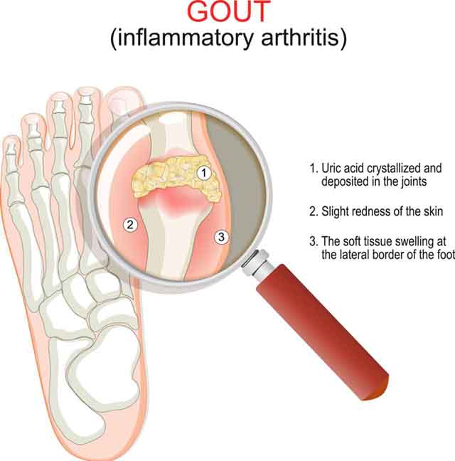 Joint Health Diagram